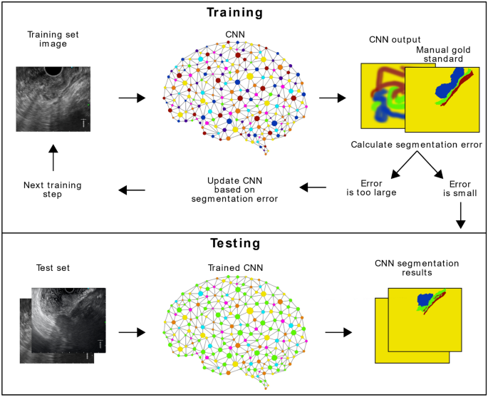 Deep learning for segmentation of colorectal carcinomas on endoscopic ...