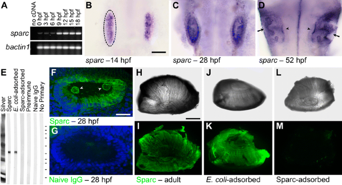 Sparc Protein Is Required for Normal Growth of Zebrafish Otoliths ...