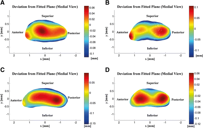 Characterization of Stapes Anatomy: Investigation of Human and