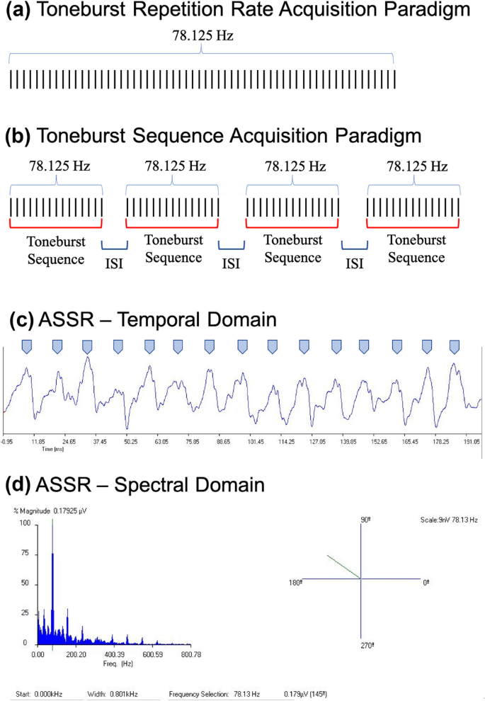 Acoustic reflex thresholds for pure tone stimuli (solid line) versus