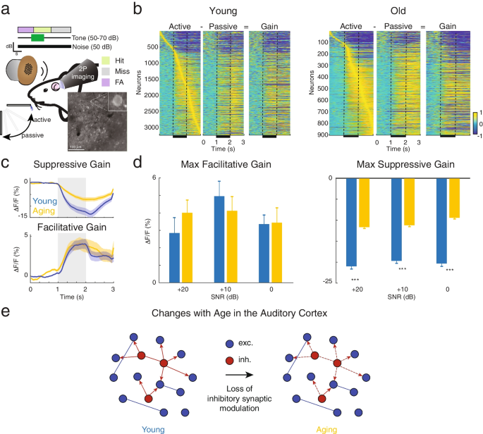 Aging in the Primary Auditory Cortex | Journal of the Association for ...