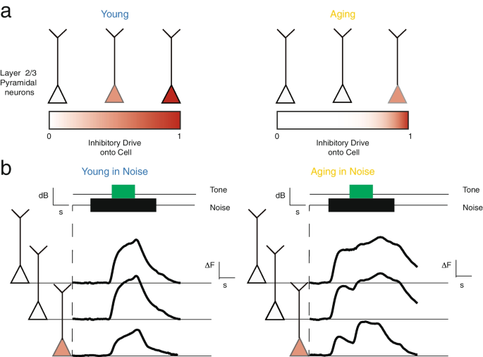 Aging in the Primary Auditory Cortex | Journal of the Association for ...
