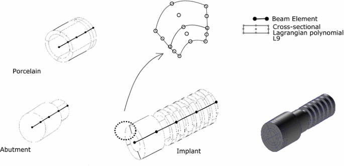 Static And Free Vibration Analyses Of Dental Prosthesis And Atherosclerotic Human Artery By Refined Finite Element Models Springerlink
