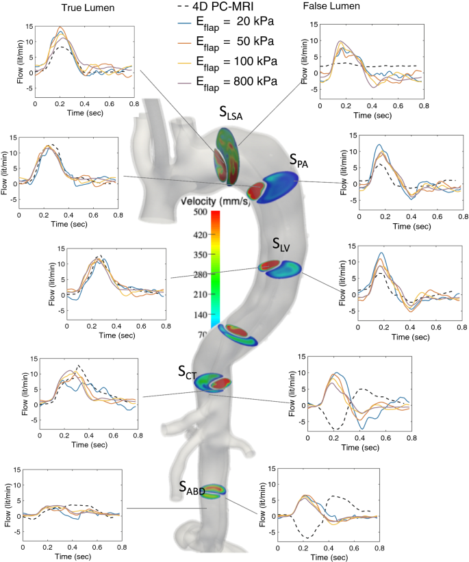 Ex vivo biaxial load testing analysis of aortic biomechanics demonstrates  variation in elastic energy distribution across the aortic zone zero -  ScienceDirect