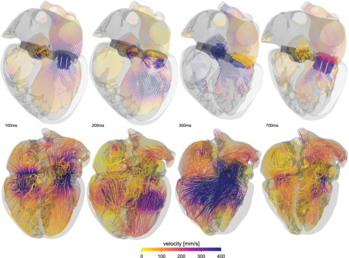 Precision medicine in human heart modeling | SpringerLink