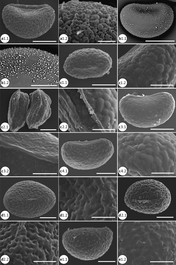 PDF) Spore Morphology and Ornamentation of Fern and Fern-Allies