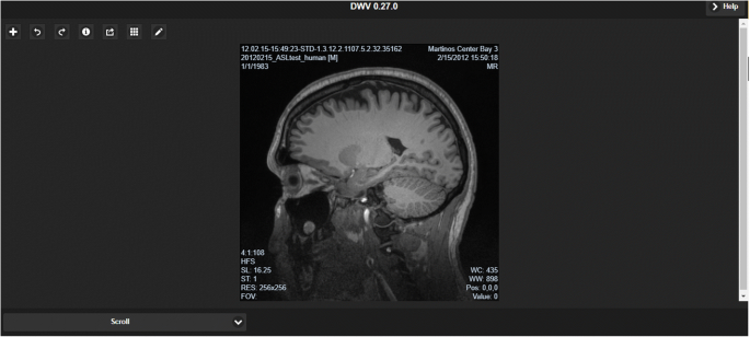 what is the best free dicom viewer for a general person what is the best free dicom viewer for a general person