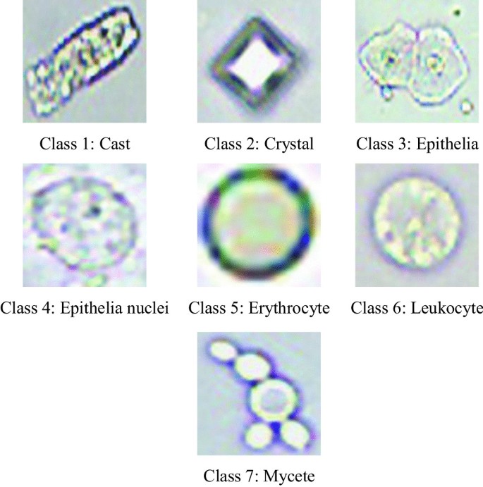 Inspection of visible components in urine based on deep learning