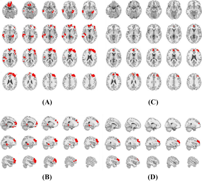 Volumetric Integrated Classification Index: An Integrated Voxel-Based ...