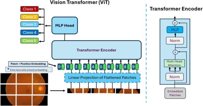 OcuViT: A Vision Transformer-Based Approach for Automated Diabetic ...