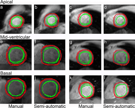 how to read mri images with dcss