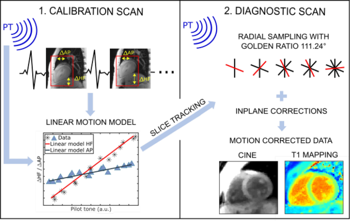 fætter Fisker Exert Pilot tone-based prospective correction of respiratory motion for  free-breathing myocardial T1 mapping | SpringerLink