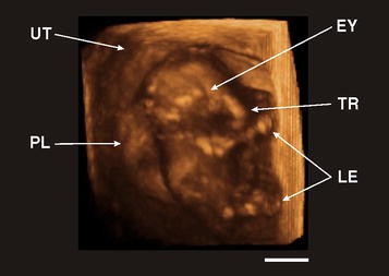 Ultrasonography: an important tool in captive breeding management ...