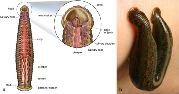 Medical leech therapy in plastic reconstructive surgery