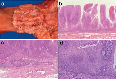 figure 31