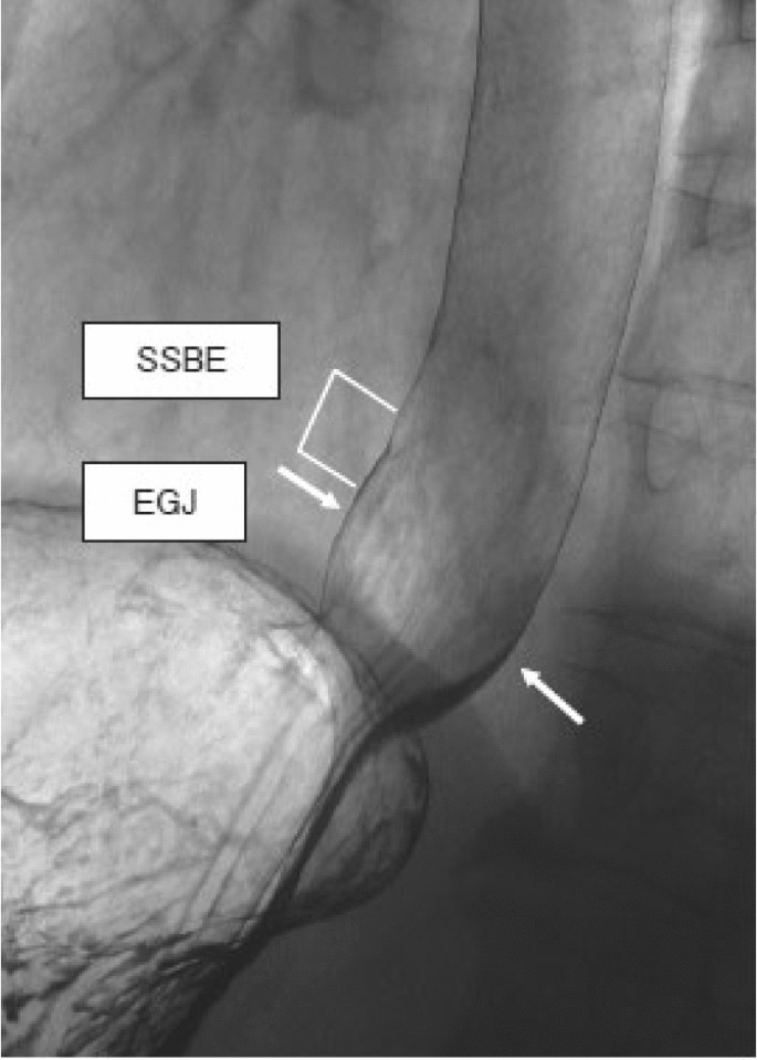 figure 22