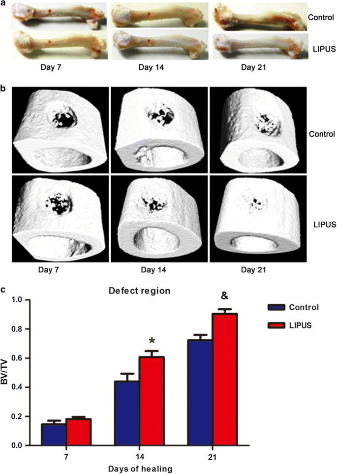 Inhibition Of Myostatin Signal Pathway May Be Involved In Low Intensity Pulsed Ultrasound Promoting Bone Healing Springerlink