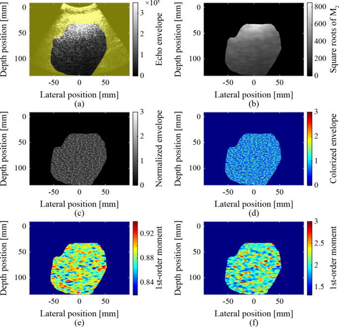 Convolutional neural network classification of ultrasound parametric ...