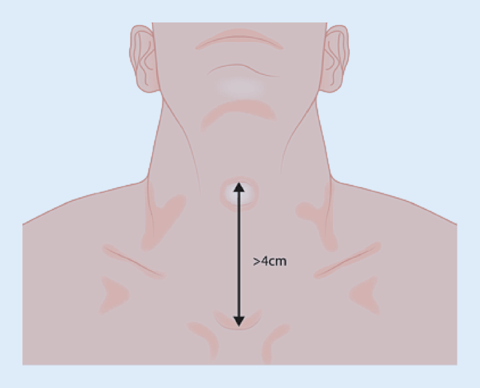 vibration in der lunge beim atmen Vibrationen bei COPD, Asthma und Co. – wie können sie helfen? main image 0