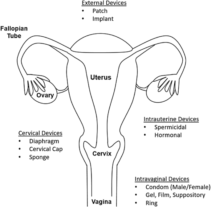 Biomaterials and Contraception: Promises and Pitfalls | SpringerLink Biomaterials and Contraception: Promises and Pitfalls | SpringerLink