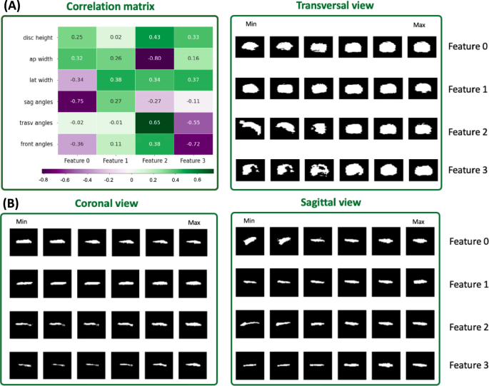 A CNN Autoencoder for Learning Latent Disc Geometry from Segmented ...