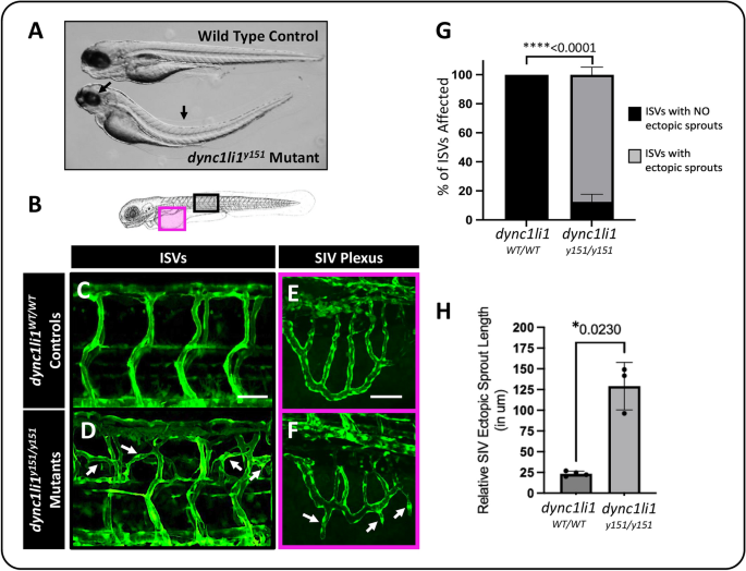rho glutathione sprouts S-Acetyl-L-glutathione main image 1