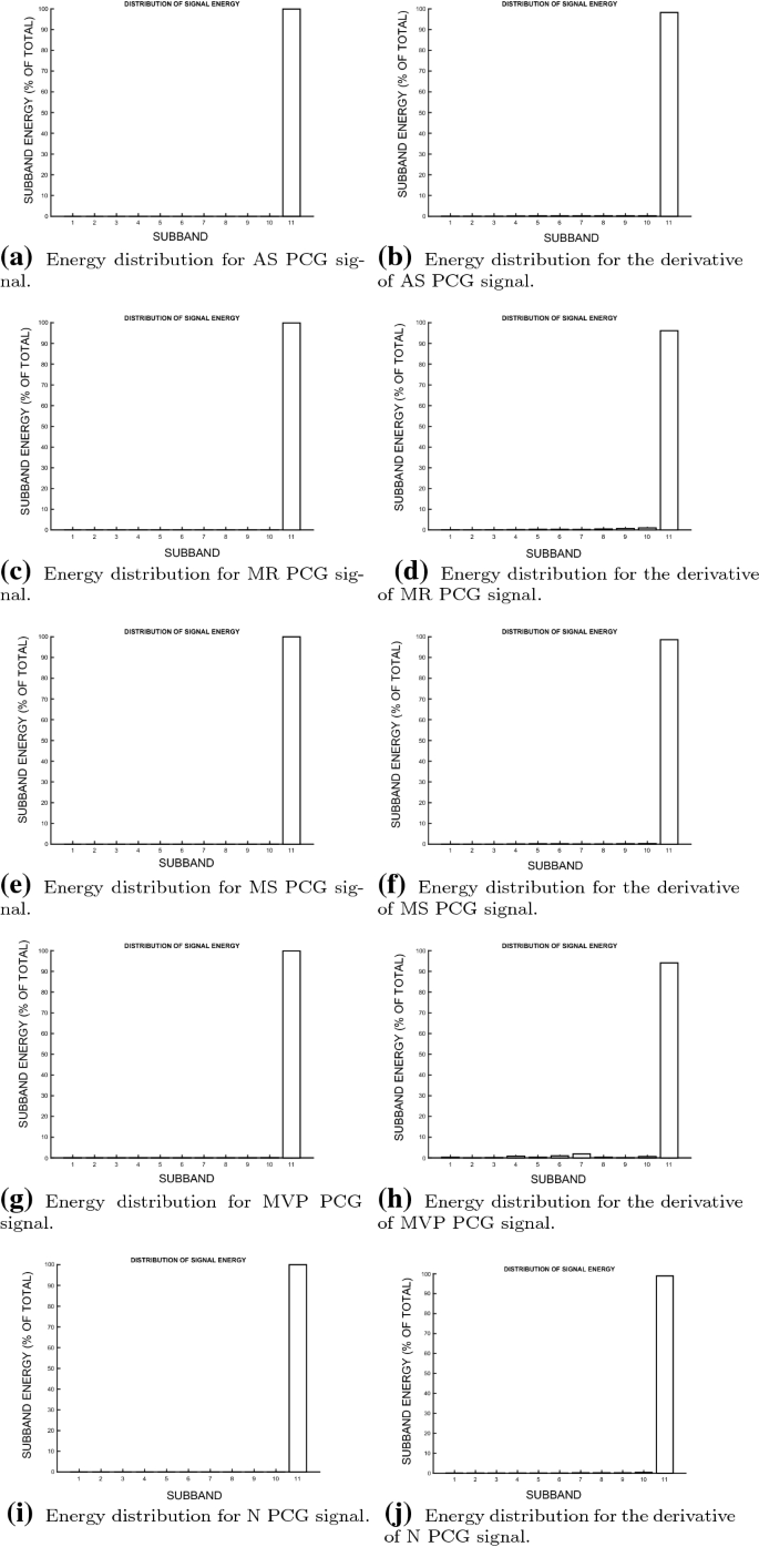 Detection Of Heart Valve Disorders From Pcg Signals Using Tqwt Fa Mvemd Shannon Energy Envelope And Deterministic Learning Springerlink