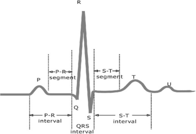 An Electrocardiogram Signal Compression Techniques A Comprehensive Review Springerlink