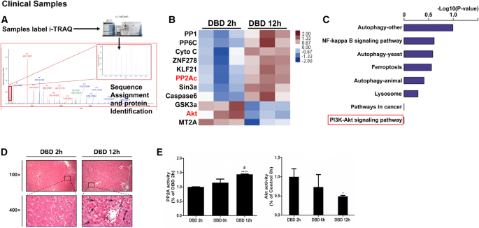 PP2Ac upregulates PI3K-Akt signaling and induces hepatocyte ...