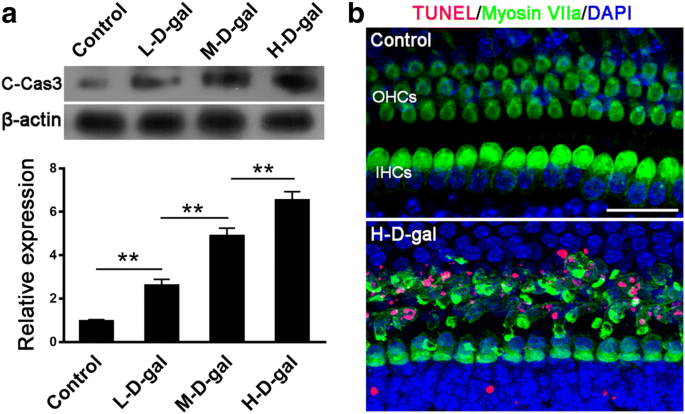 D Galactose Induced Oxidative Stress And Mitochondrial Dysfunction In The Cochlear Basilar Membrane An In Vitro Aging Model Springerlink