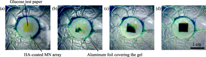 Microfluidic Chip To Interface Porous Microneedles For Isf Collection Springerlink