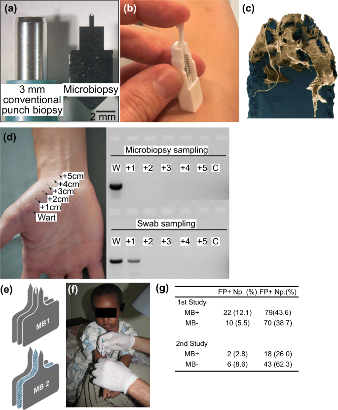 A Review Of Microsampling Techniques And Their Social Impact Springerlink