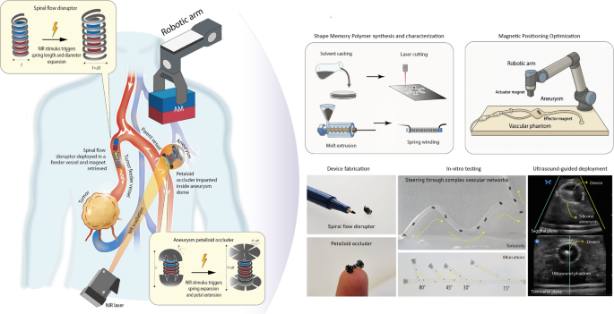 Graphical abstract: magnetically-guided NIR-triggered microdevices for endovascular aneurysm therapy