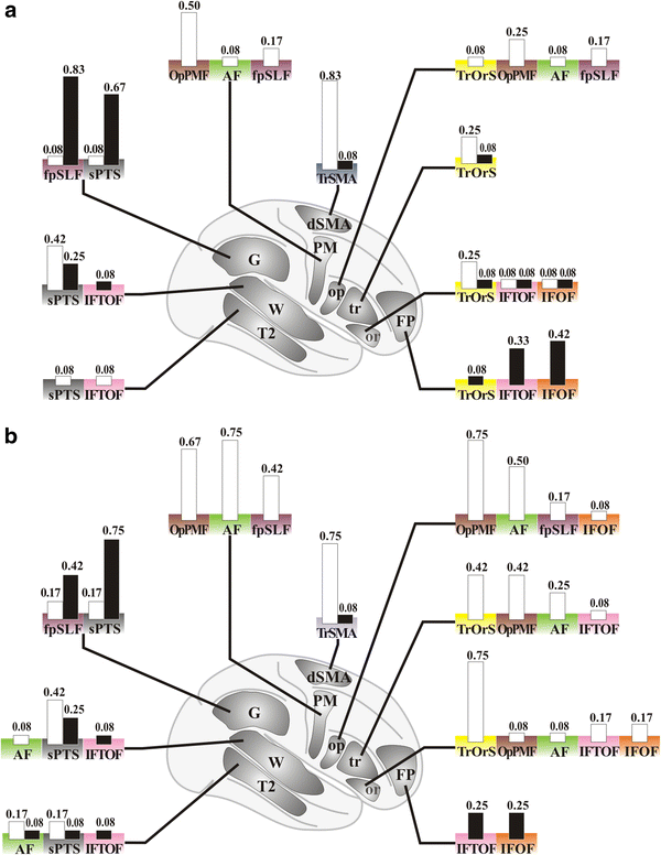 Extended Broca S Area In The Functional Connectome Of Language In Adults Combined Cortical And Subcortical Single Subject Analysis Using Fmri And Dti Tractography Springerlink