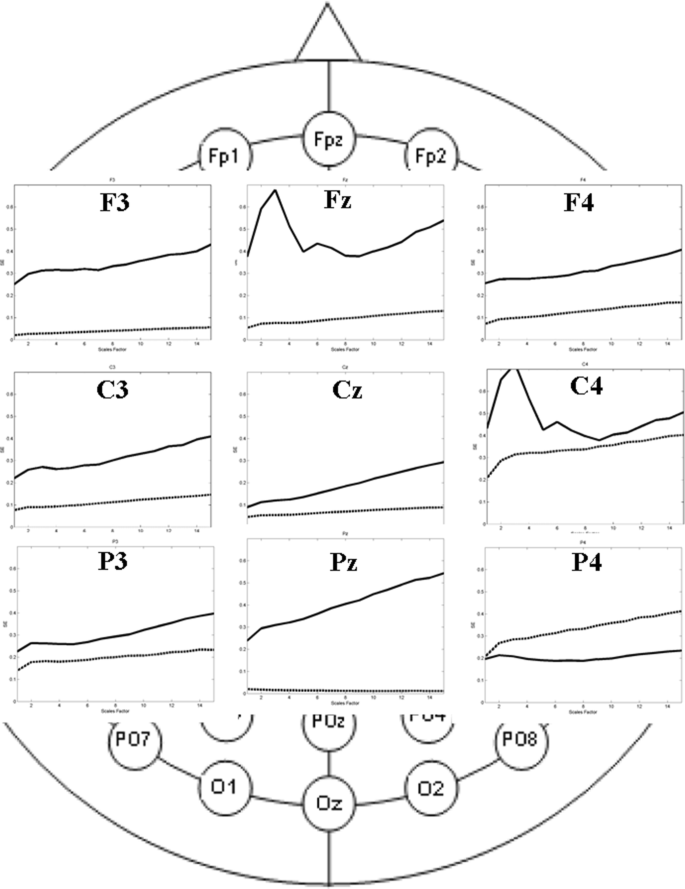 Classification of autism spectrum disorder based on sample entropy