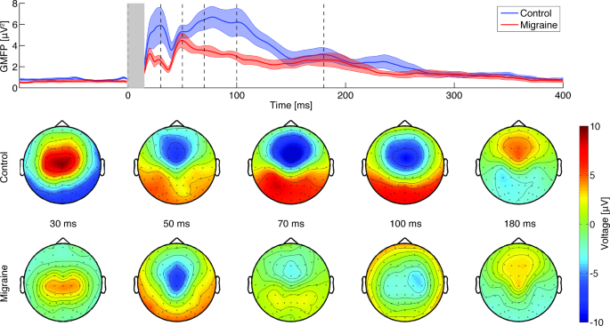 TMS-evoked EEG potentials demonstrate altered cortical excitability in  migraine with aura | SpringerLink