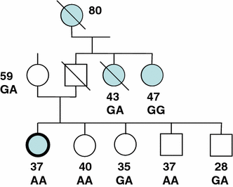 Is Brca2 C 9079 G A A Predisposing Variant For Early Onset Breast Cancer Springerlink