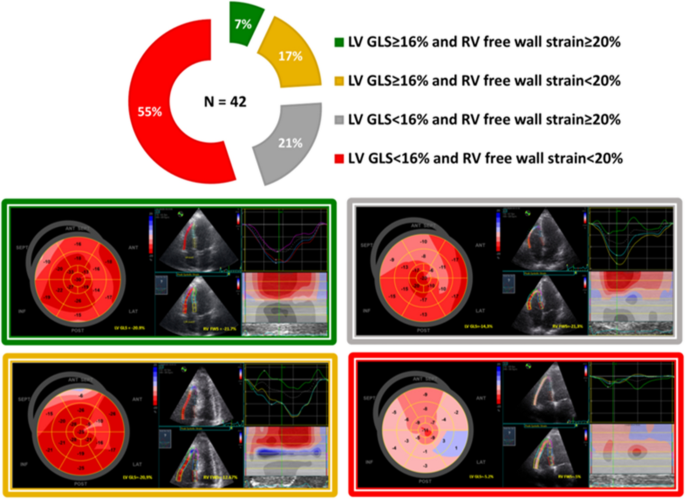 Patterns of cardiac involvement characterized by strain echocardiography in  amyloidosis