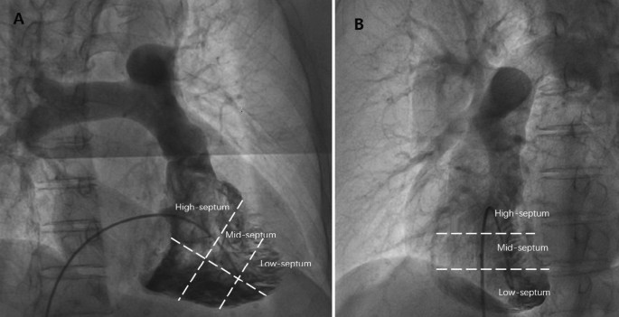 Cross sans - ultronic - Folioscope