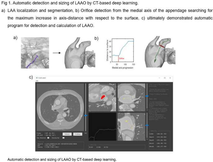 Frontiers  Fully Automatic Classification of Brain Atrophy on NCCT Images  in Cerebral Small Vessel Disease: A Pilot Study Using Deep Learning Models