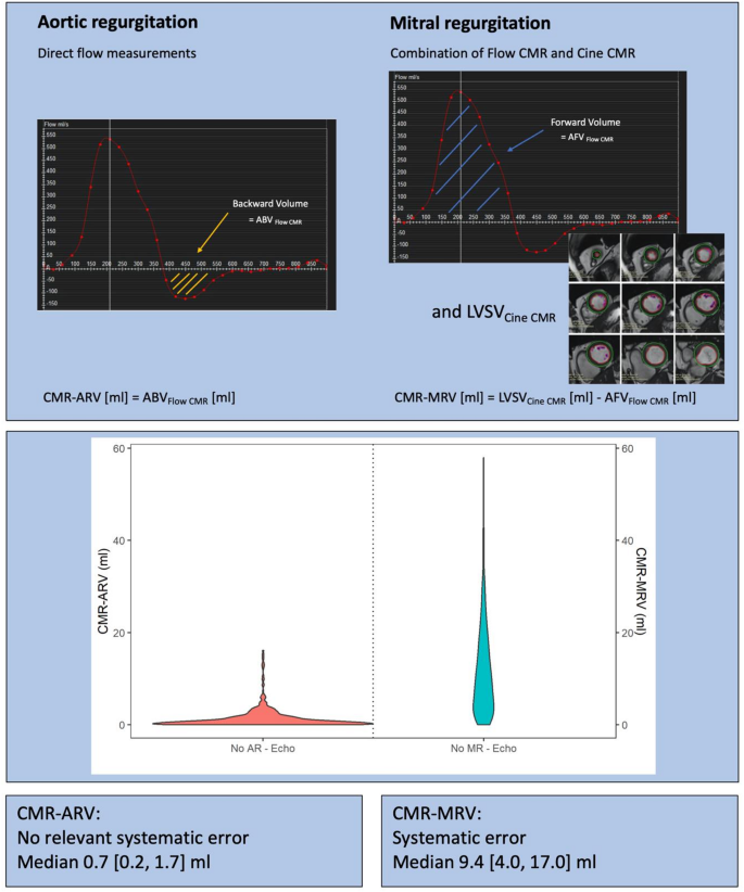Assessment of aortic and mitral valve regurgitation volumes by ...