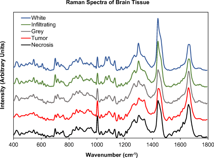 Applications of Raman spectroscopy in cancer diagnosis | SpringerLink