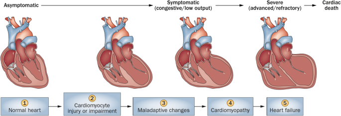 Long-term Cardiovascular Toxicity in Children, Adolescents, and