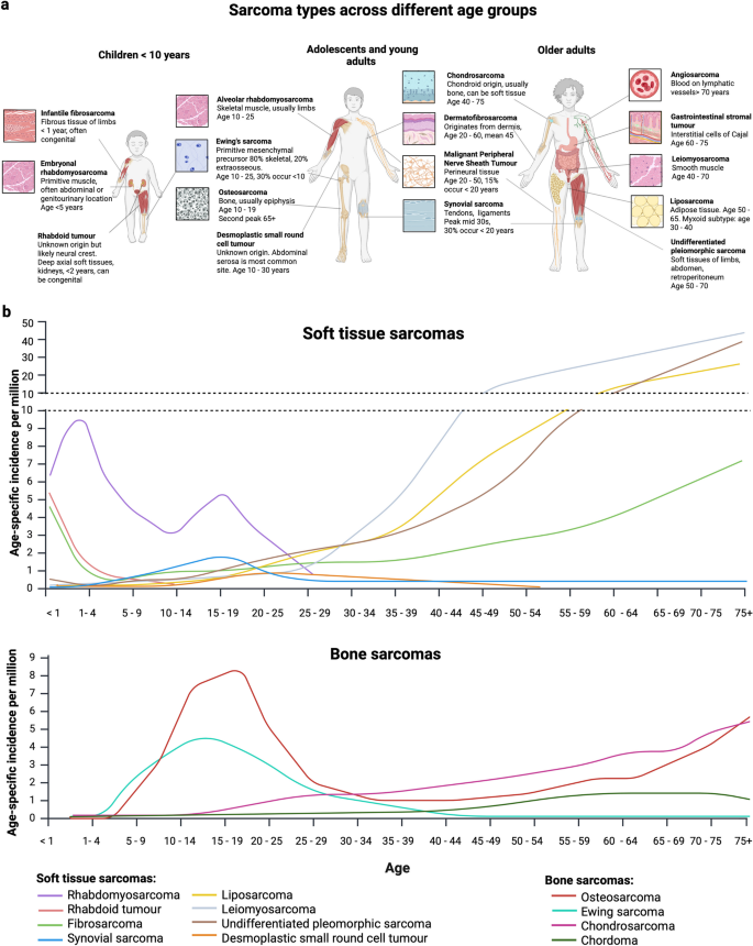Targeting developmental vulnerabilities in childhood sarcomas | Cancer ...