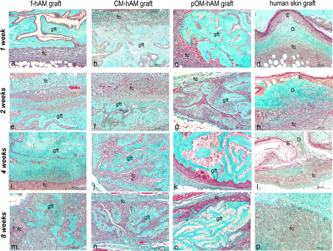 Fresh And In Vitro Osteodifferentiated Human Amniotic Membrane Alone Or Associated With An Additional Scaffold Does Not Induce Ectopic Bone Formation In Balb C Mice Springerlink
