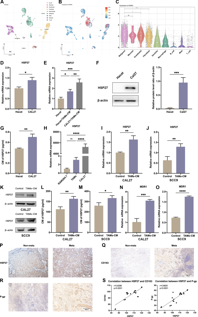 HSP27/IL-6 axis promotes OSCC chemoresistance, invasion and migration ...