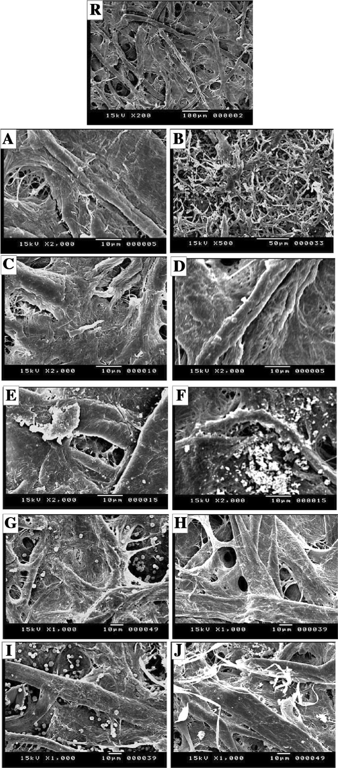 Monitoring The Effect Of Biosynthesized Nanoparticles Against Biodeterioration Of Cellulose Based Materials By Aspergillus Niger Springerlink