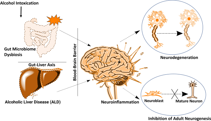 Detrimental Effects of Alcohol-Induced Inflammation on Brain Health: From Neurogenesis to Neurodegeneration | SpringerLink Detrimental Effects of Alcohol-Induced Inflammation on Brain Health: From Neurogenesis to Neurodegeneration | SpringerLink