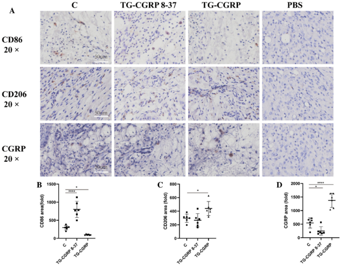 Correction: Expression of CGRP in the Trigeminal Ganglion and Its ...