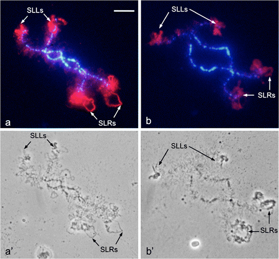 Precocious detection on amphibian oocyte lampbrush chromosomes of subtle  changes in the cellular localisation of the Ro52 protein induced by in  vitro culture | SpringerLink